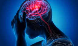 Infarto cerebral. Síntomas